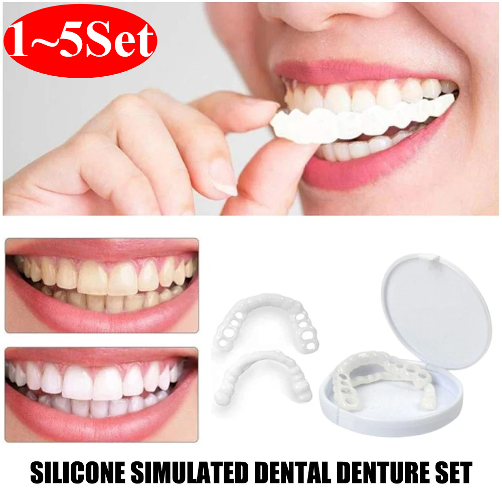 Teeth Whitening For Braces - Pop ite Cover Zahnaufheller für Interdentalräume