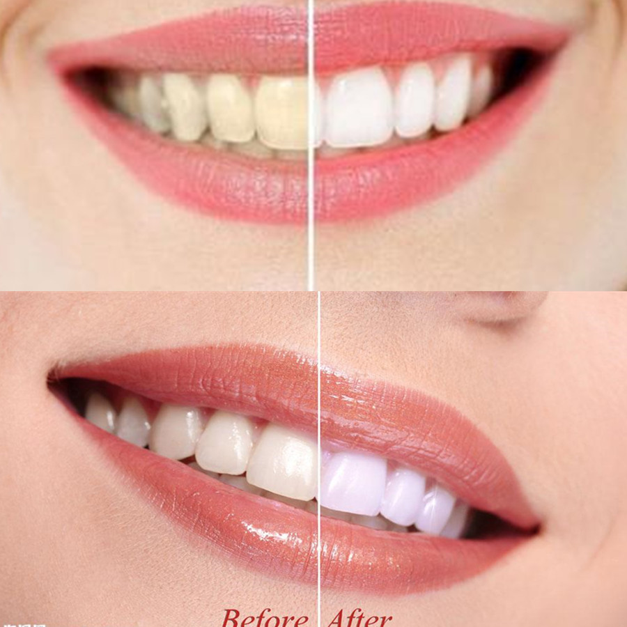Bambus Holzkohle Zähne Zahn De – Teeth Whitening Q&M Bewertung und Preis