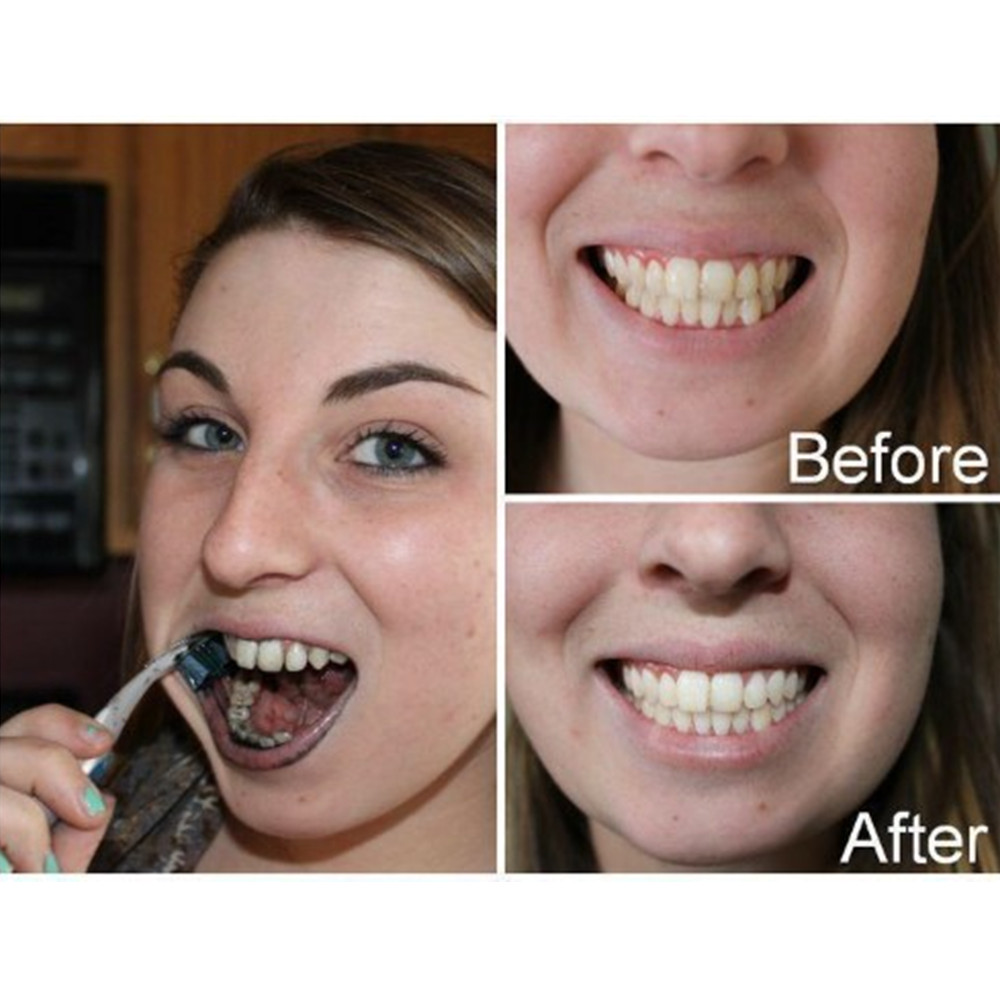 Bambus Holzkohle Zähne Zahn De – Teeth Whitening Q&M Bewertung und Preis