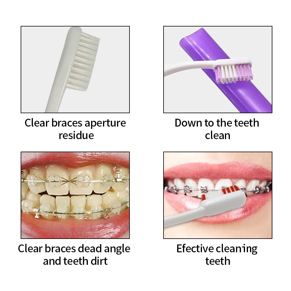 8 Teile/satz Kieferorthopädisc – Teeth Whitening For Braces Bewertung und Preis