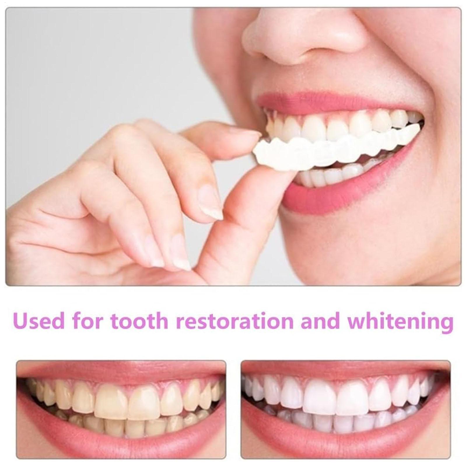 Zahnprothesen für Ober- und Un – Teeth Whitening For Braces Bewertung und Preis