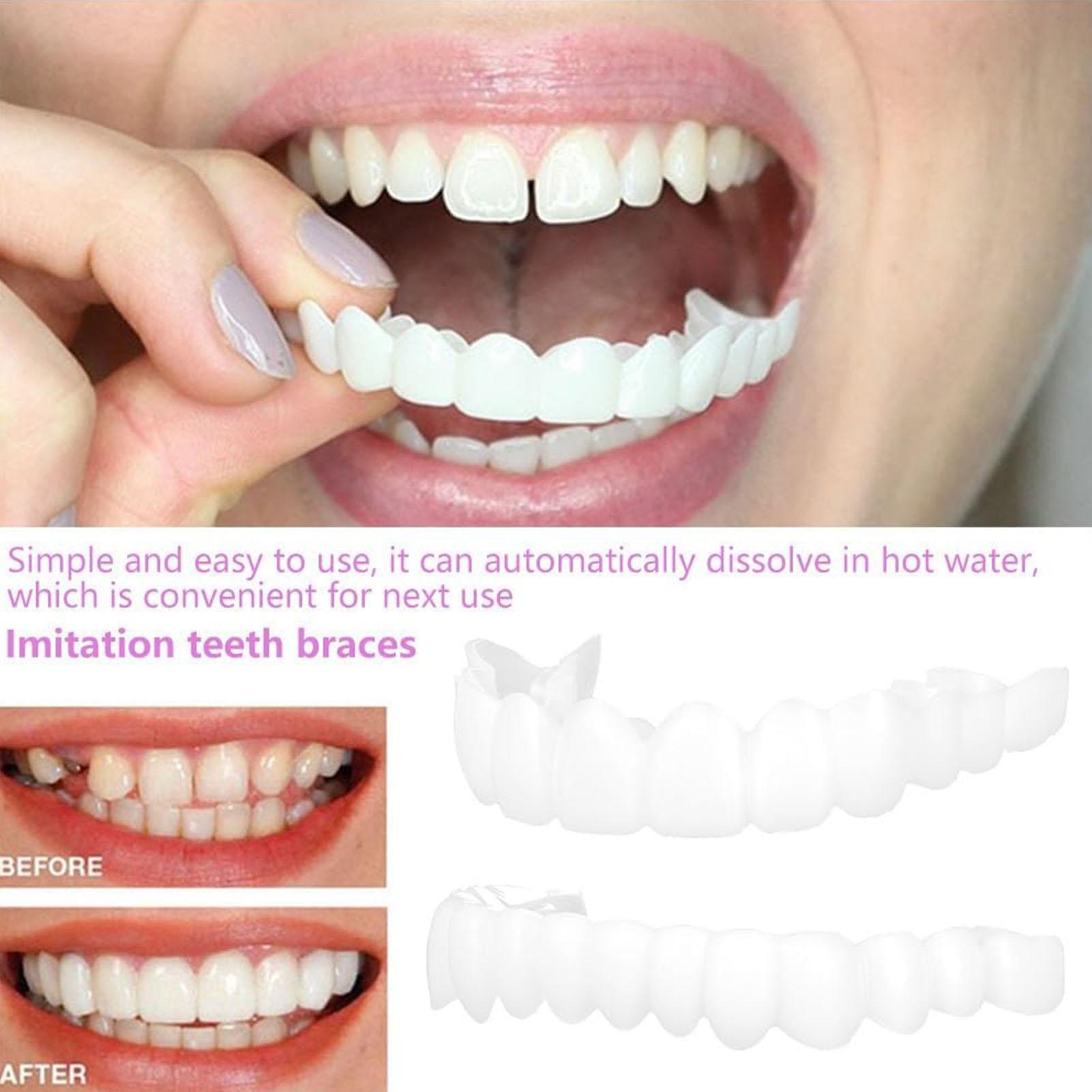 Zahnprothesen für Ober- und Un – Teeth Whitening For Braces Bewertung und Preis