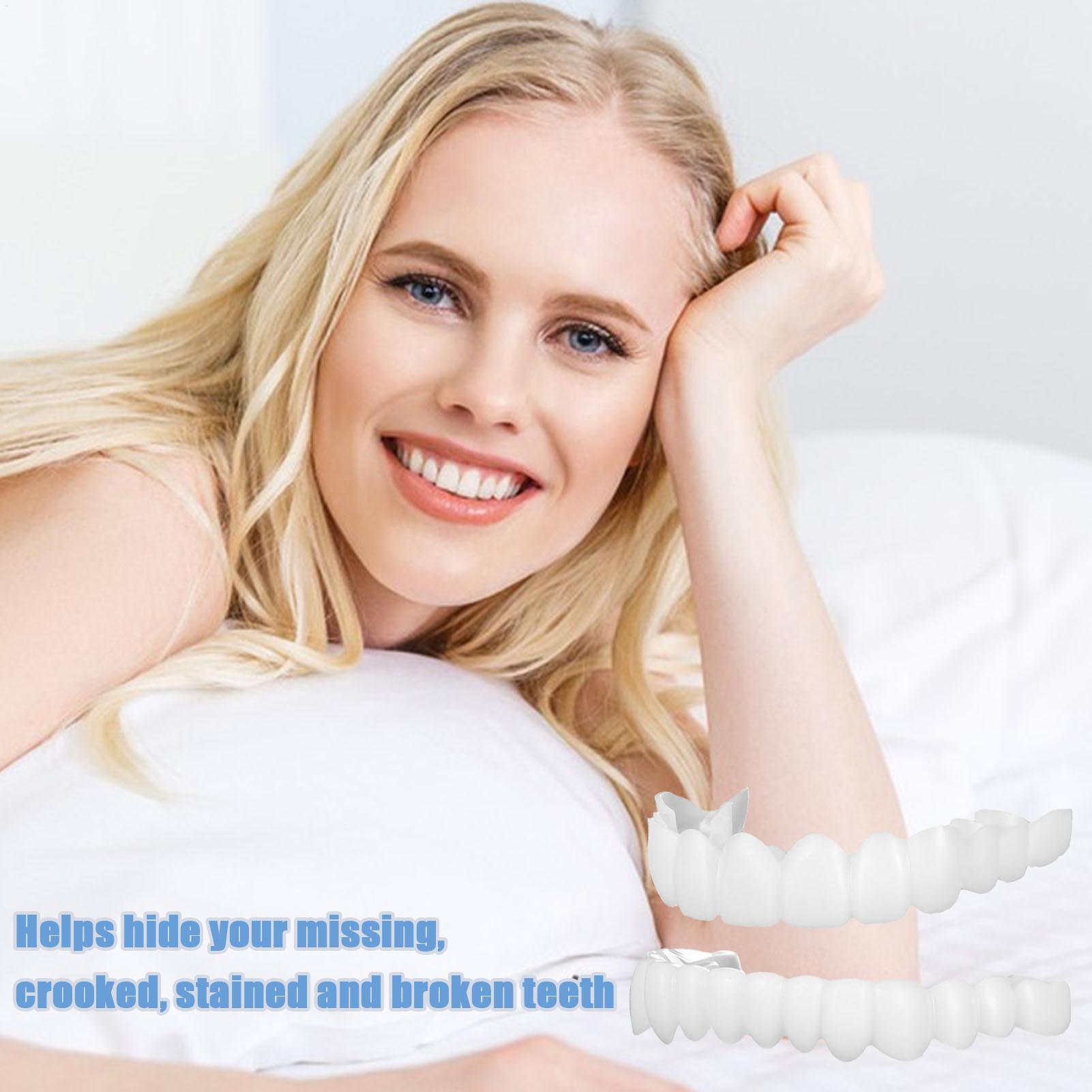 Zahnprothesen für Ober- und Un – Teeth Whitening For Braces Bewertung und Preis