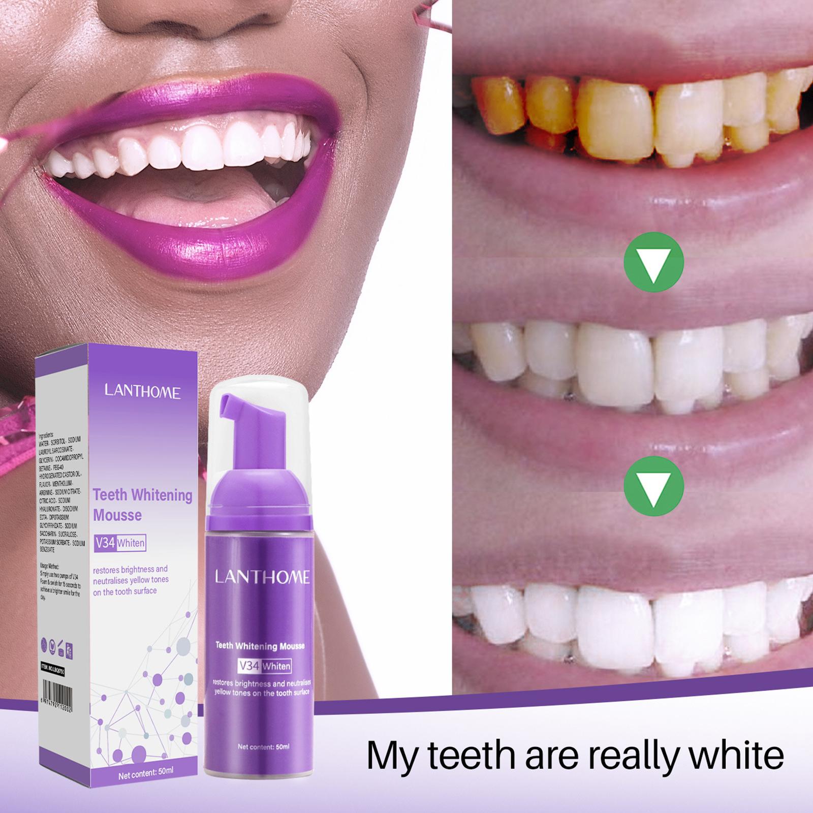 V34 Mousse Zahnreinigungs-Zahn – Teeth Whitening Effective Bewertung und Preis