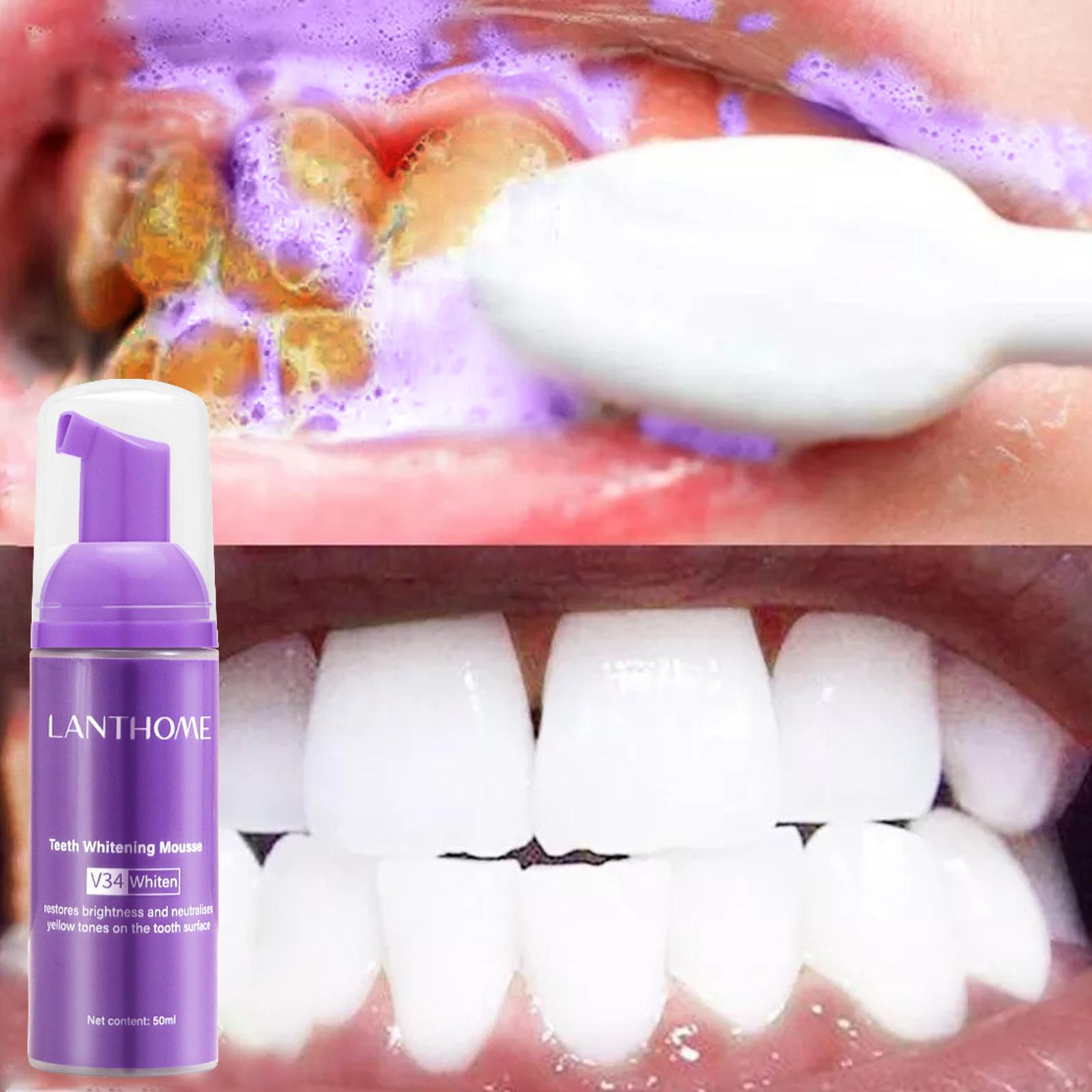 V34 Mousse Zahnreinigungs-Zahn – Teeth Whitening Effective Bewertung und Preis