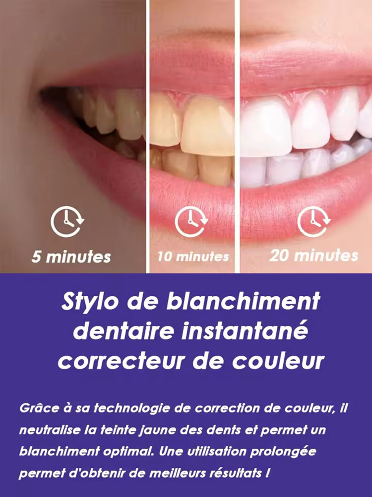 8ml*2 Zahnaufhellungs-Stift-Se – Teeth Whitening Effective Bewertung und Preis