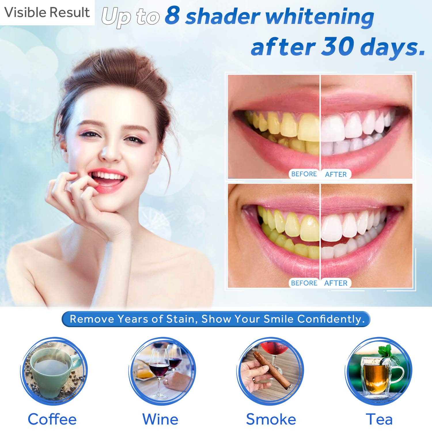 Zahnaufhellungsgel, Nachfüllsp – Teeth Whitening Gel Syringes Bewertung und Preis