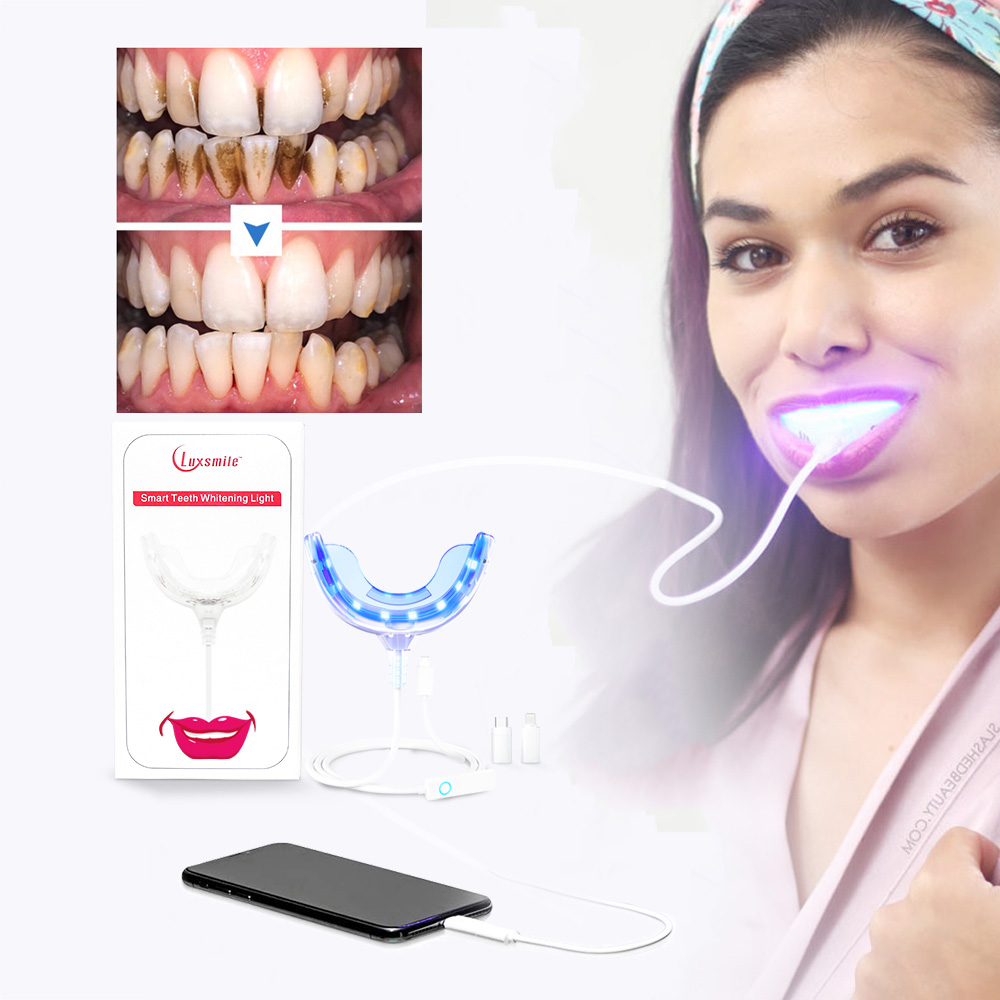 Luxsmile Smart LED Zahnaufhell – Teeth Whitening Blue Light Bewertung und Preis