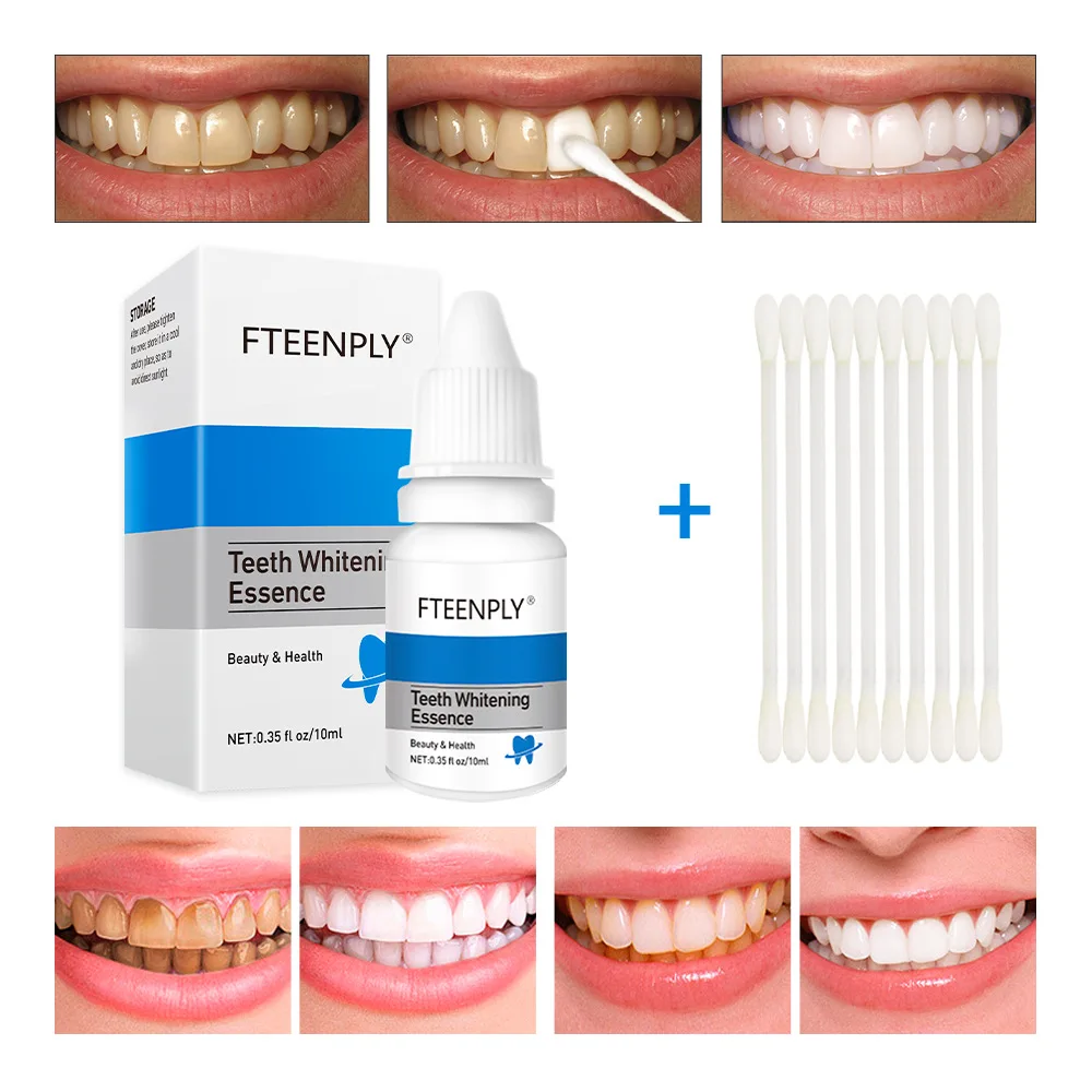 FTEENPLY Zahnaufhellung Essenz – Teeth Whitening Diy Bewertung und Preis