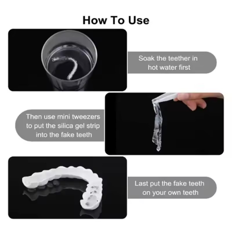Zahn-Veneers Zahnaufhellung Za – Teeth Whitening For Braces Bewertung und Preis