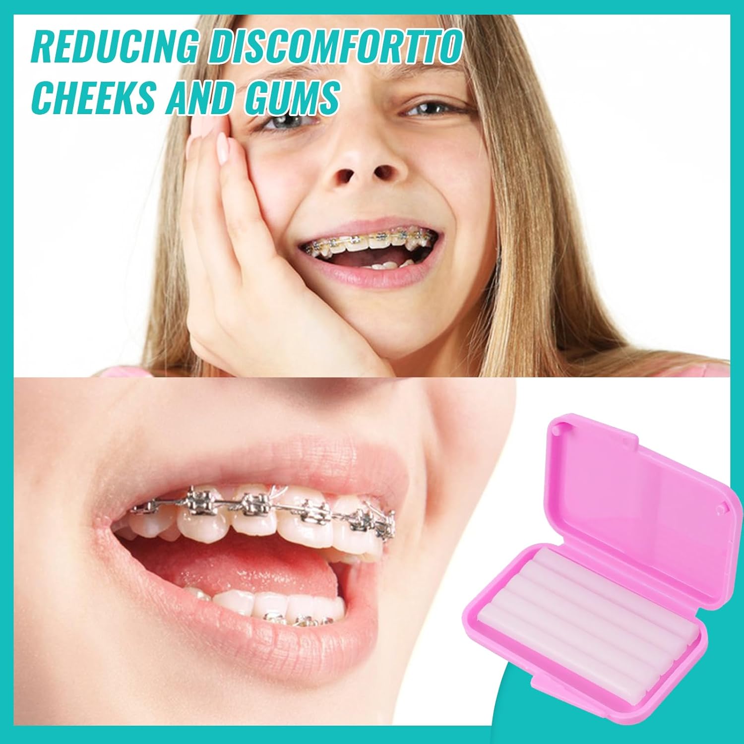 10 box Dental Kieferorthopädis – Teeth Whitening For Braces Bewertung und Preis