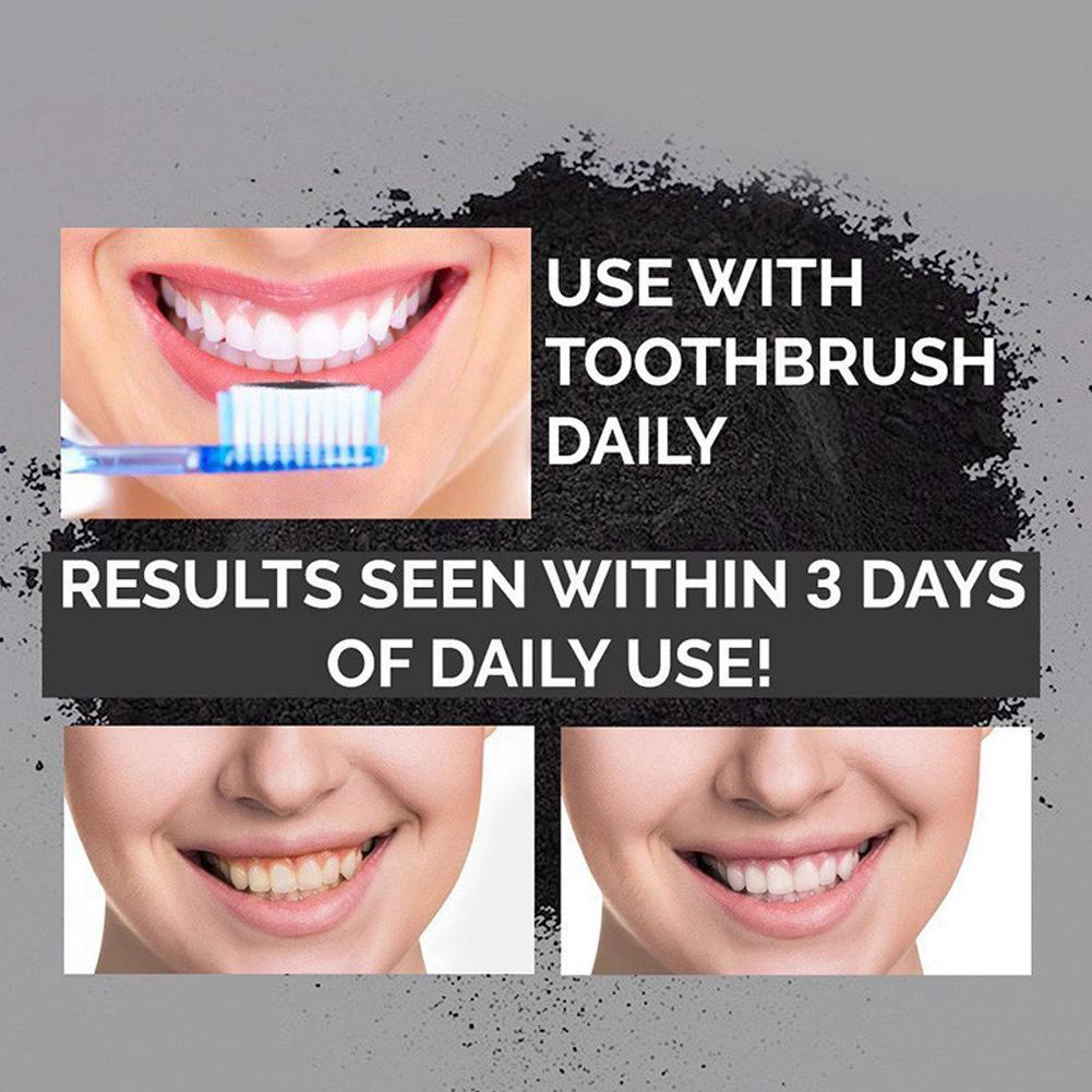 Zahnaufhellungspulver Natürlic – Teeth Whitening Activated Organic Charcoal Bewertung und Preis